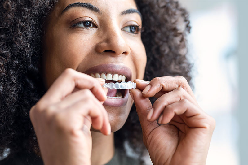 Clear Aligner Therapy in Concord