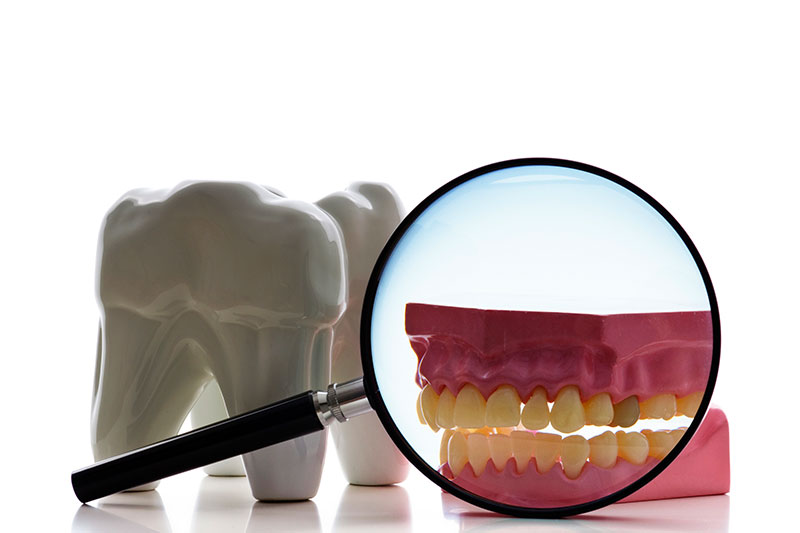 Root Canal Treatment in Concord