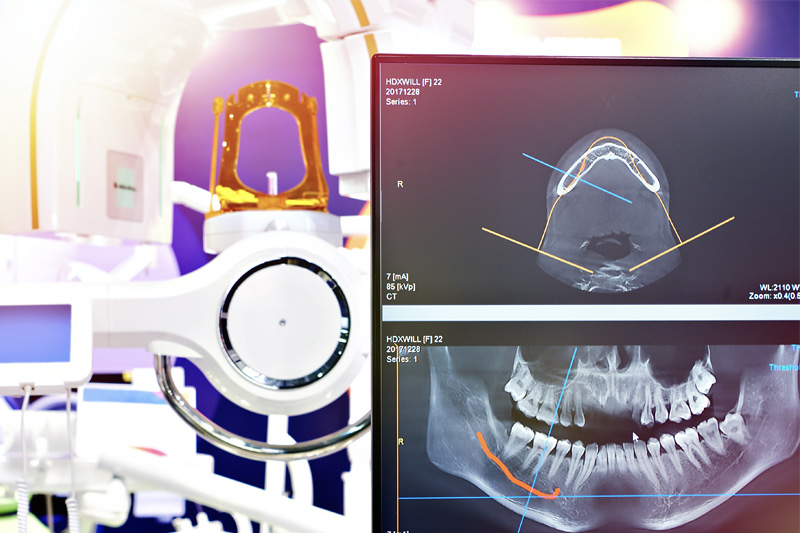 Digital X-Rays in Concord
