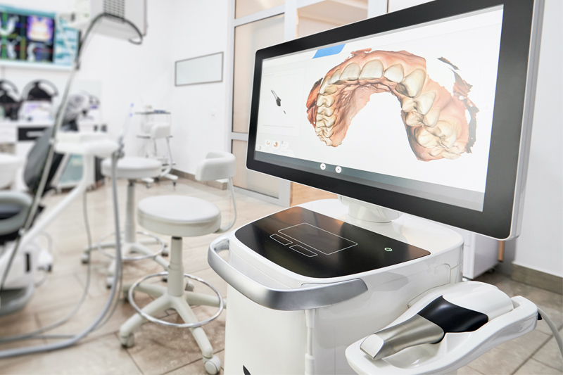 Intra-Oral Scanner in Concord